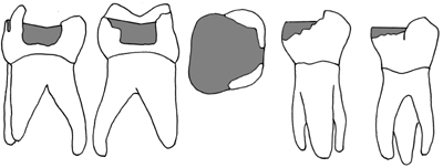 Composite Core